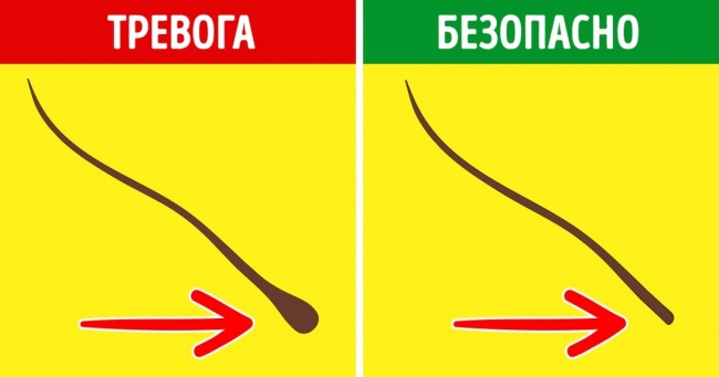 10 причин, чому випадають волосся, і як це зупинити