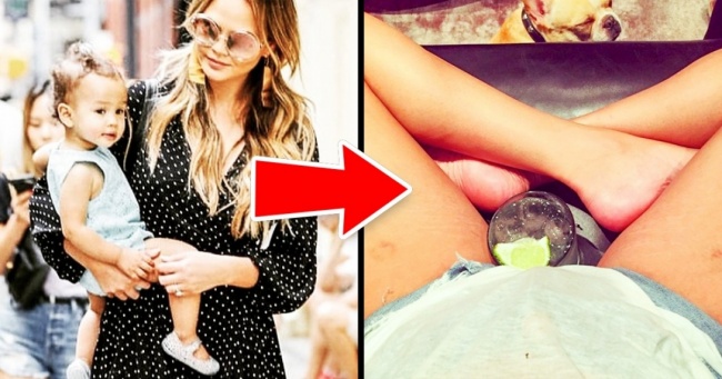 Такі ж, як ми: 17 зірок, які не збираються ховати свої недоліки