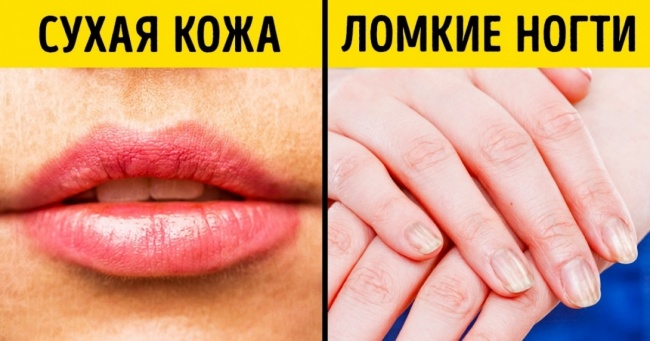 7 ознак, за якими можна зрозуміти, що ваше тіло просить про допомогу