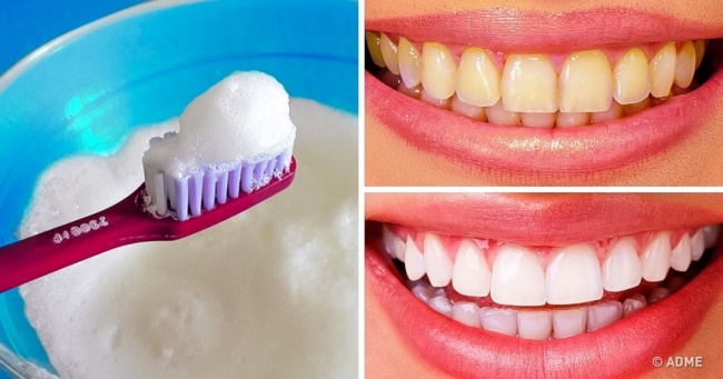 9 ефективних способів відбілити зуби, не виходячи з дому