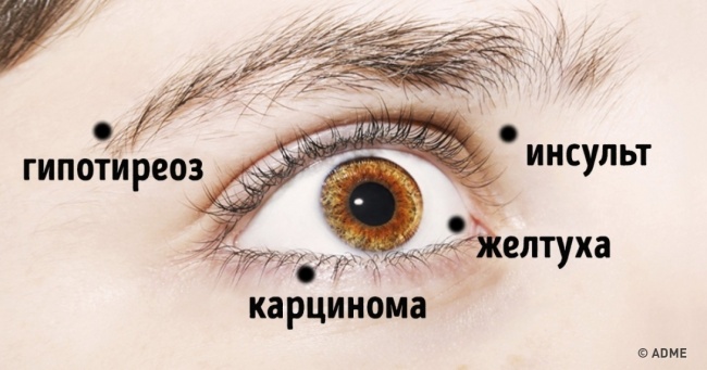 8 речей, які очі намагаються сказати про ваше здоров'я