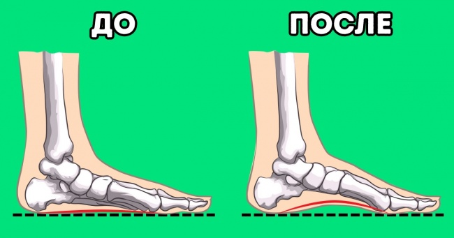 7 вправ від ортопедів, щоб збільшити висоту склепіння стопи і зменшити біль в ногах
