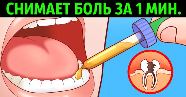 8 домашніх засобів, що знімають зубний біль