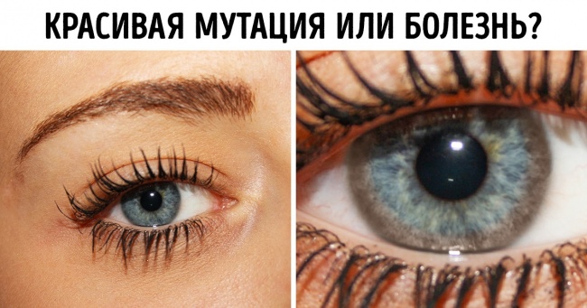 20+ особливостей зовнішності, які можуть стати приводом для візиту до лікаря