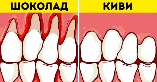 Як зберегти здоров'я зубів і відбілити їх за допомогою їжі