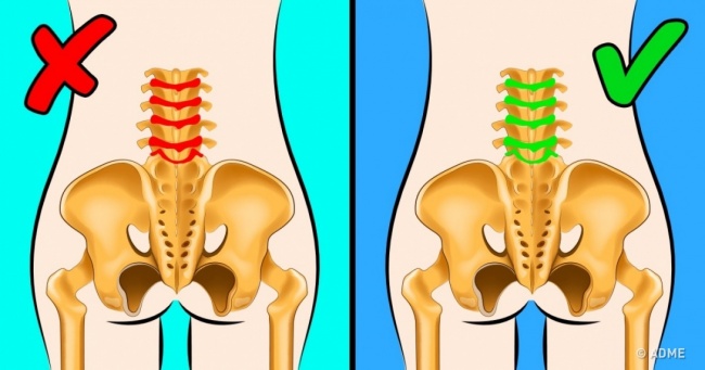 Вам знадобиться 5 хвилин, щоб позбутися гострого болю в попереку