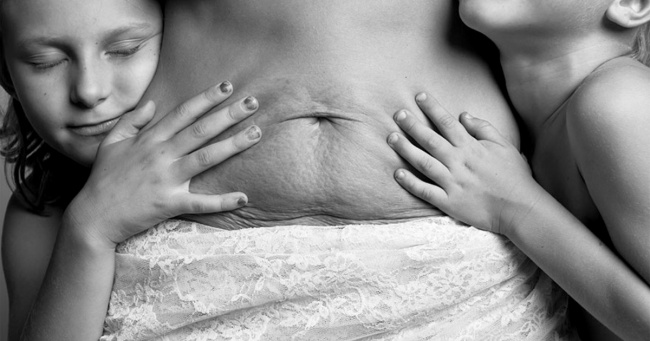 10 фотографій, які показують, що тіло жінки після пологів виглядає зовсім не так, як в журналах про вагітність