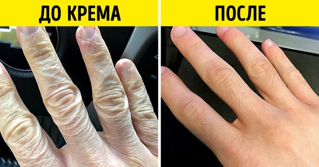 20+ фотографій «до» і «після», які доводять, що час і трохи зусиль іноді творять дива