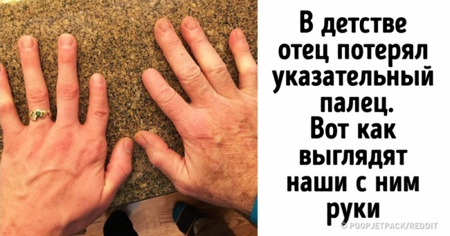25 дітей, яким від батьків дісталася справжня родзинка