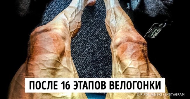 15 фото про силу людського духу