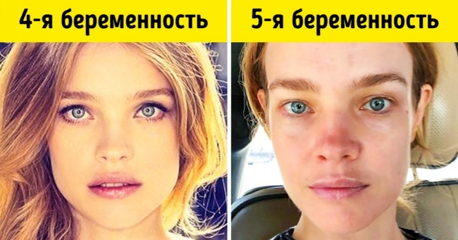 9 дивних, але правдивих фактів про вагітність, про яких вам не розповість доктор
