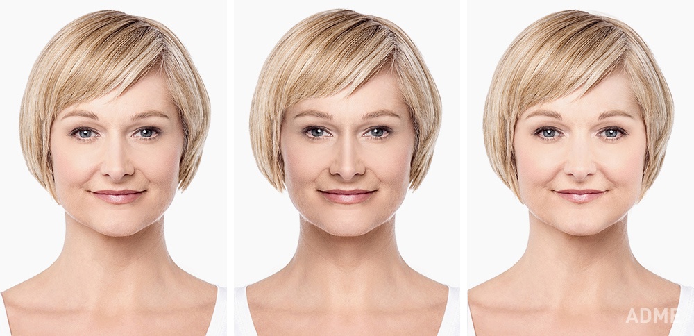 Чи можна зробити обличчя більш симетричним?