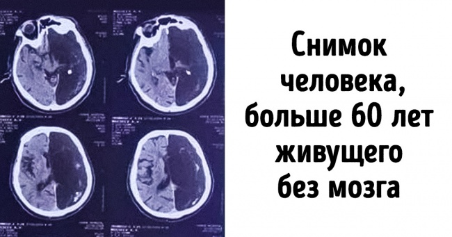 20 незбагненних фактів, які раз і назавжди змінять ваше уявлення про власному тілі