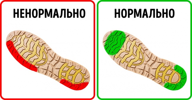 8 захворювань, які можна попередити, якщо уважно подивитися на вашу взуття