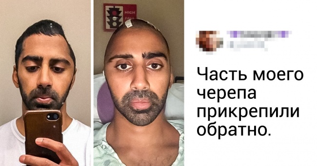 16 знімків, які зрозуміліше наукових статей розкажуть про нашому тілі