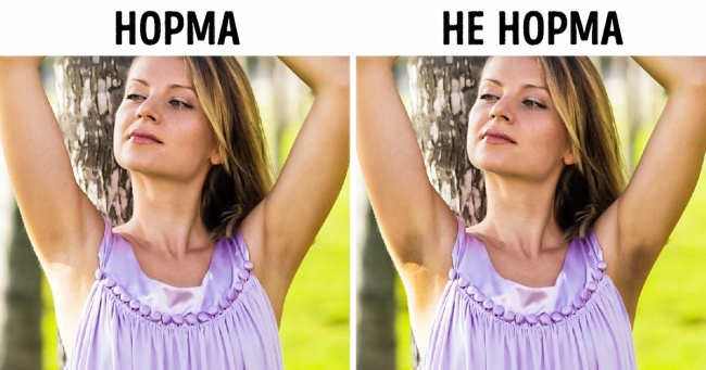 9 неочевидних змін у тілі, за якими можуть ховатися небезпечні хвороби