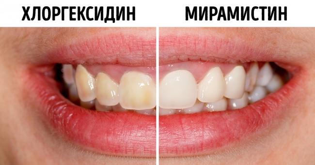 13 лікарських призначень, які ми зазвичай ігноруємо, а потім страждаємо