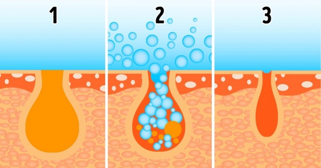 Звідки беруться розширені пори і як домогтися гладкої шкіри без дорогих салонних процедур