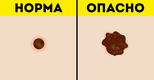 12 важливих питань про жіноче здоров'я, які слід задати лікареві в залежності від вашого віку