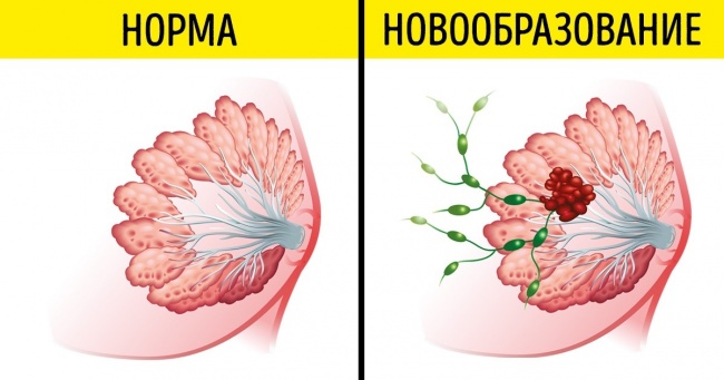 Як часто потрібно звертатися до лікаря, щоб ловити хвороби на ранніх стадіях