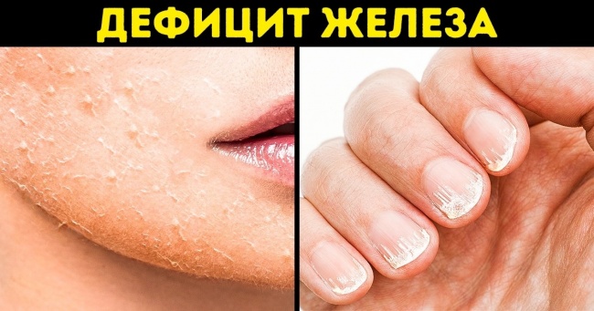5 корисних речовин, яких найчастіше не вистачає нашому організму, і звідки їх отримати