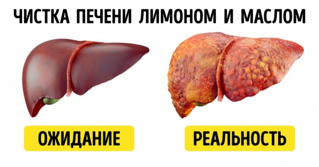 8 народних методів лікування, небезпечних для вашого здоров'я