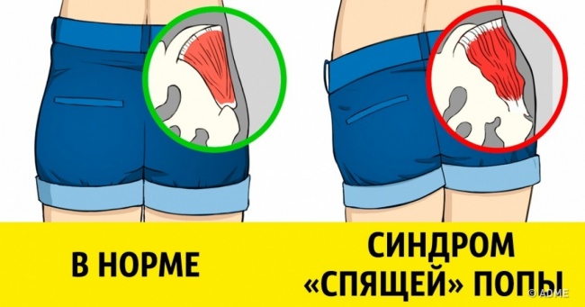 Ця хвороба загрожує тим, хто працює в офісі