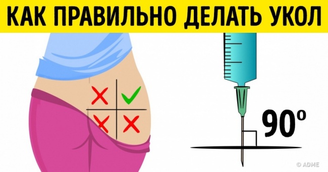 10 відомих прийомів першої допомоги, що 90 % людей роблять неправильно