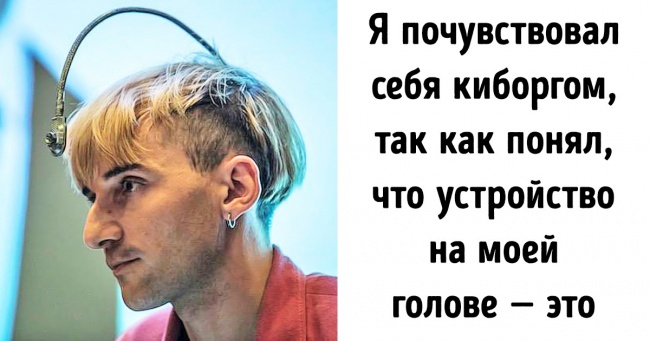 Хлопець імплантував в голову антену. На його місці багато хто вчинив би так само