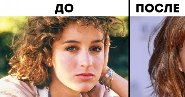 Як виглядали 10 зірок до того, як звернулися до пластичних хірургів