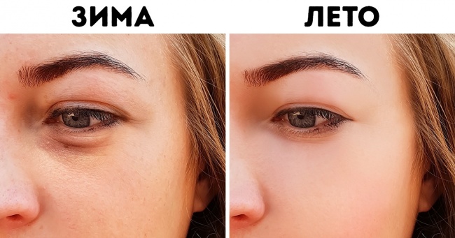 7 зимових чинників, з-за яких ми виглядаємо старше