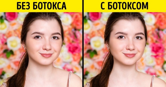 10 дивних косметичних процедур, на які готові піти дівчата заради краси