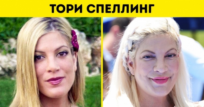 Як виглядали знаменитості до пластики