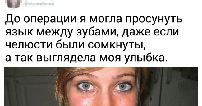 16 осіб, які довірили пластичних хірургів своє здоров'я і однозначно виграли