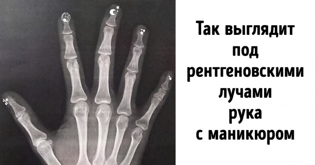 23 фото, на яких знайомі речі виглядають загадковіше інопланетних об'єктів