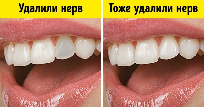 7 відповідей на питання про догляд за зубами, які потрібно знати, щоб рідше бувати у стоматолога
