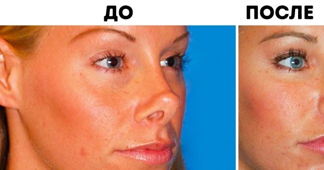 15 жінок, які змінили всього одну деталь своєї зовнішності і перетворилися до невпізнання