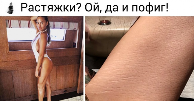 11 знаменитих жінок, які створюють тренд на фото без ретуші