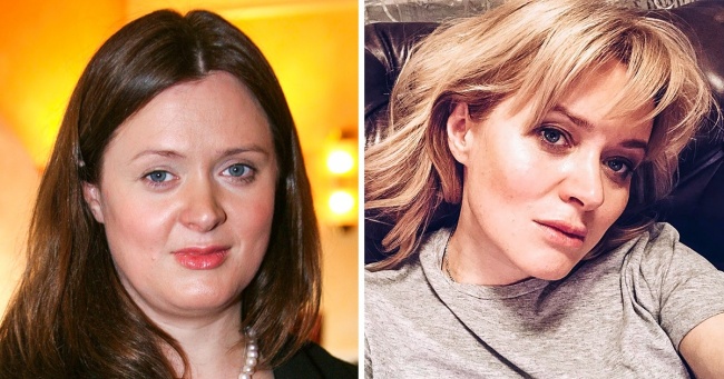 20 російських зірок, які попрацювали над зовнішністю і стали виглядати молодше