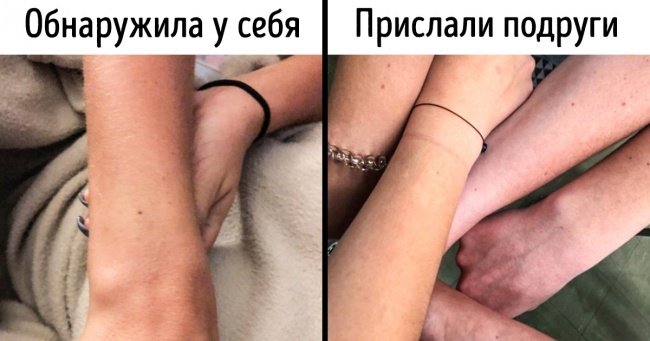 Ненавмисний твіт відкрив всьому світу, що практично у кожної дівчини є родимка на одному і тому ж місці