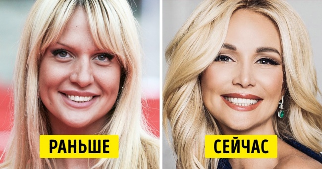 Як виглядали знаменитості до того, як вирішили поворожити над своєю зовнішністю