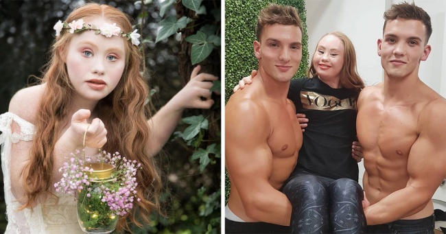 22-річна модель з синдромом Дауна має намір стати «ангелом» Victoria's Secret і змінити уявлення про красу