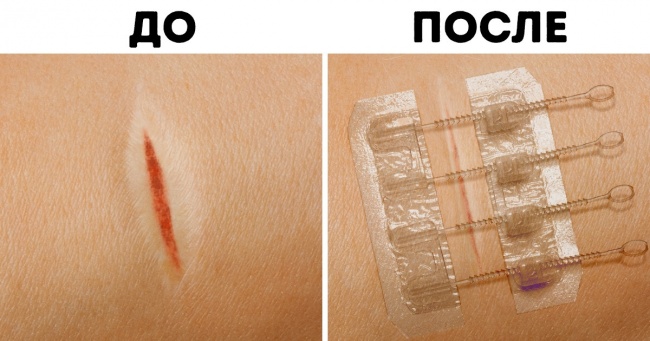 15 розумних гаджетів, які допоможуть вести ЗСЖ абсолютно не напружуючись