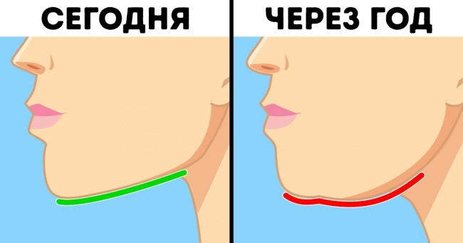 Чим небезпечний синдром комп'ютерної шиї і як уникнути незворотних наслідків для здоров'я