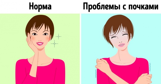 9 неочевидних симптомів, які говорять про те, що з нирками щось не в порядку