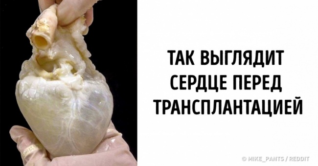 20+ дивовижних речей, про які ви чули, але які навряд чи бачили